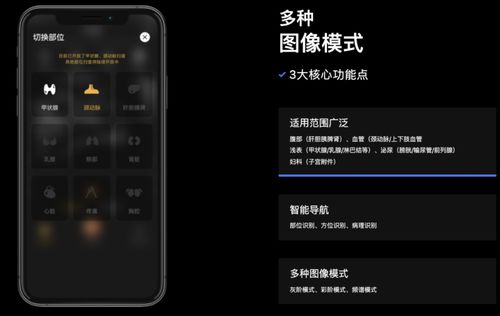 3年7轮融资，深至科技的超声AI 资本热潮下的硬核实力与软件研发真章